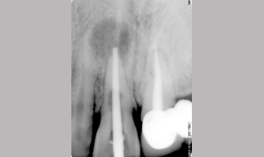 Dental clinic in Anand                        